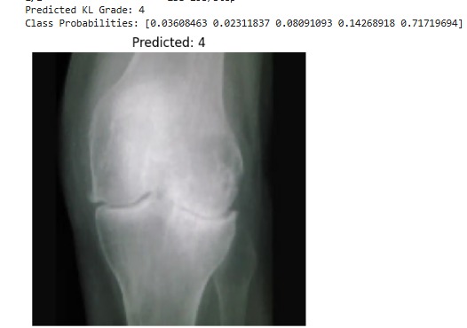 affanned399's tweet photo. #KneeOsteoarthritis #KLGrading #BiomechanicsAI #MusculoskeletalAI #OrthopedicAI #MedicalImagingAI #DeepLearning #CNN #ExplainableAI #GradCAM #IntegratedGradients #CartilageAnalysis #JointHealthAI #AIForHealthcare #ClinicalDecisionSupport https://t.co/JnOqpAK6Kz