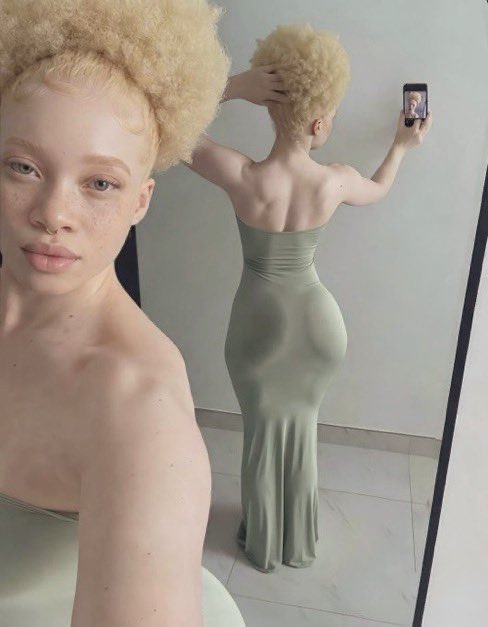 Yes Albinos exists in Africa 

Rate her beauty out of /10