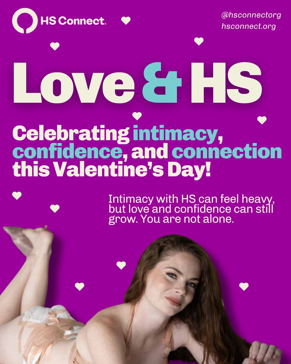 HSConnectOrg's tweet image. Happy Valentine’s Day 💗

Here is your reminder that you are always worthy of love and affection. 

We see you. We get you. We got you. 

#HSConnect #HidradenitisSuppurativa #HSCommunity #ChronicIllnessSupport #HSAdvocacy #ValentinesDay