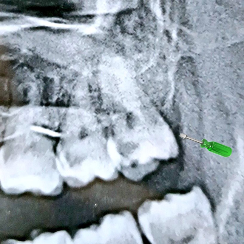 🦷Rakai🪥Virtual Dentist tweet media