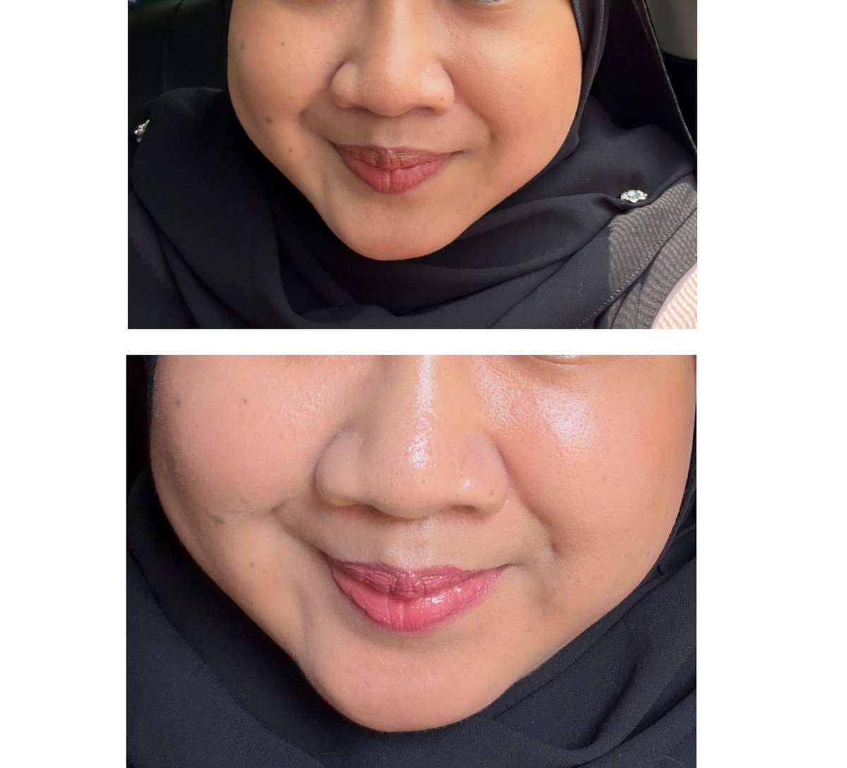 ๐๐๐๐ผ๐๐ผ๐ ๐ tweet media