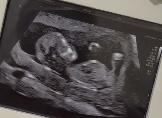 Luke F Miller tweet media