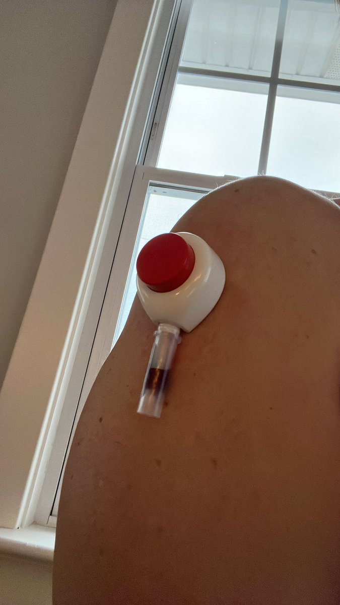 mattkita's tweet photo. I hate needles.  Trying a new blood testing solution that I can do at home and has no needles… https://t.co/Aew0Mu1wJy