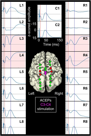[Functional brain mapping] Mitsuhashi et al.: 
