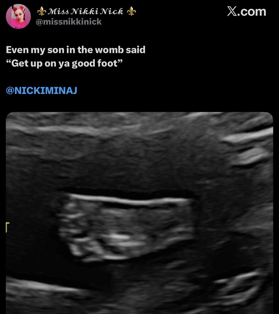 beyzhive's tweet image. …