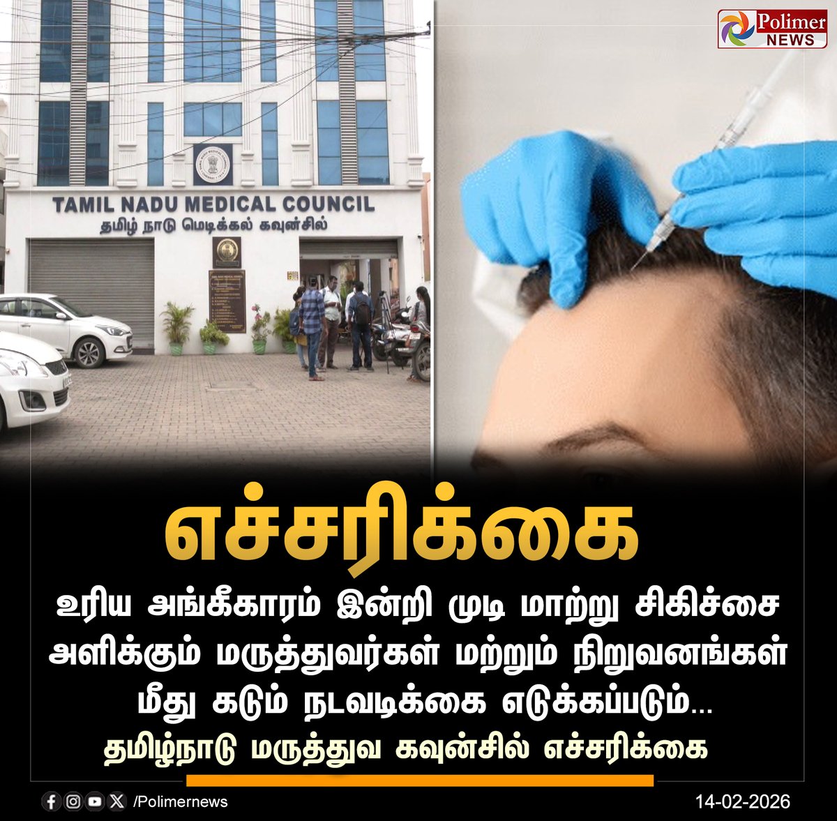 #NEWSUPDATE || முடி மாற்று சிகிச்சை நிலையங்களுக்கு எச்சரிக்கை | #HairTransplant | #Doctors | #TamilnaduMedicalCouncil | #PolimerNews