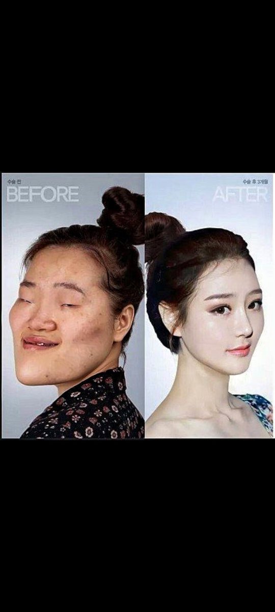 Seth060103's tweet photo. @bamb11bam beauty according to Koreans is the result of plastic 🥱🤪😝😛😜🤣 https://t.co/tQQuafnxW8