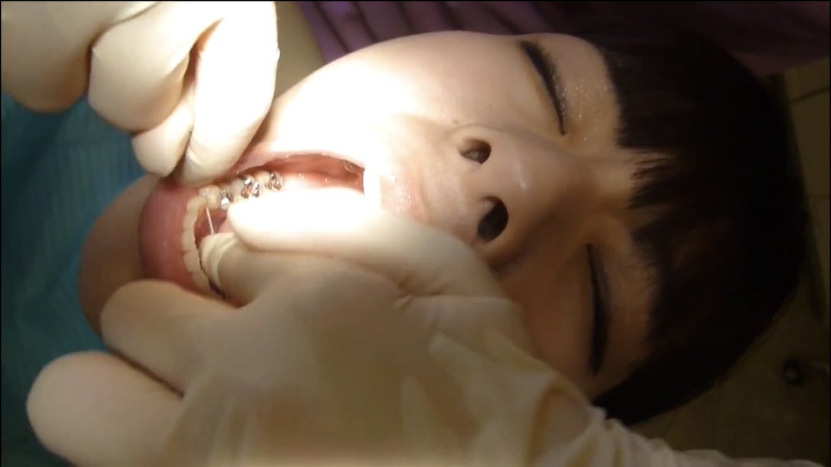 Intraoral_TX's tweet photo. 歯っぴぃ〜歯れんたいん的な本日ですが
更なる口腔治療室のバージョンアップも
ご期待いただければ嬉しい限りです(歯)

#歯科治療 #口腔 #虫歯 https://t.co/CBIJPmtpx0