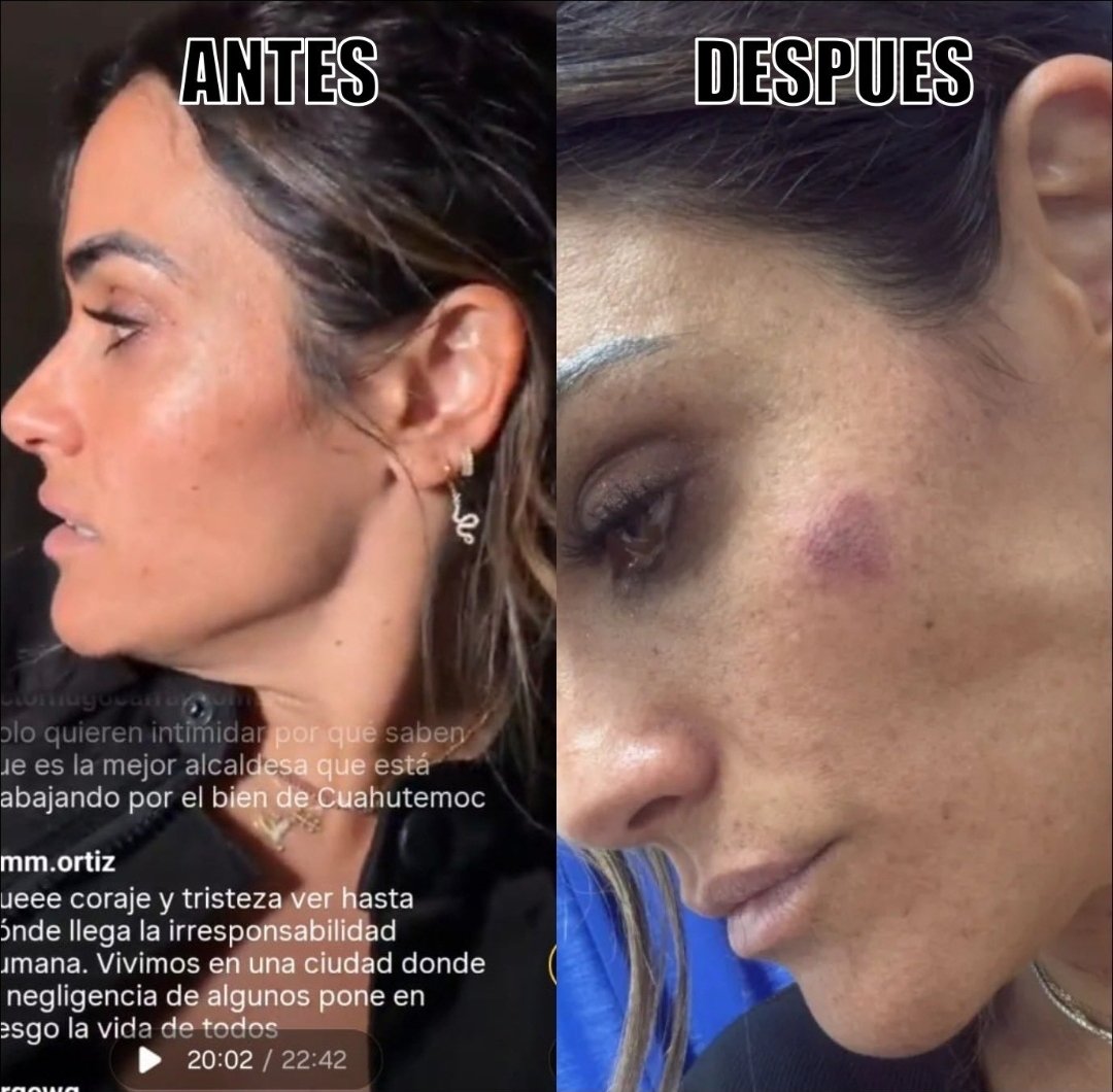 FELIZ DÍA DE #SanValentín a todos, menos a la Tiktokera <a href="/AlessandraRdlv/">Alessandra Rojo de la Vega</a> que cuando denunció que más de 200 delincuentes la habían golpeado no traía ningún rasguño, pero que después mágicamente apareció con un golpe con figura de corazón...