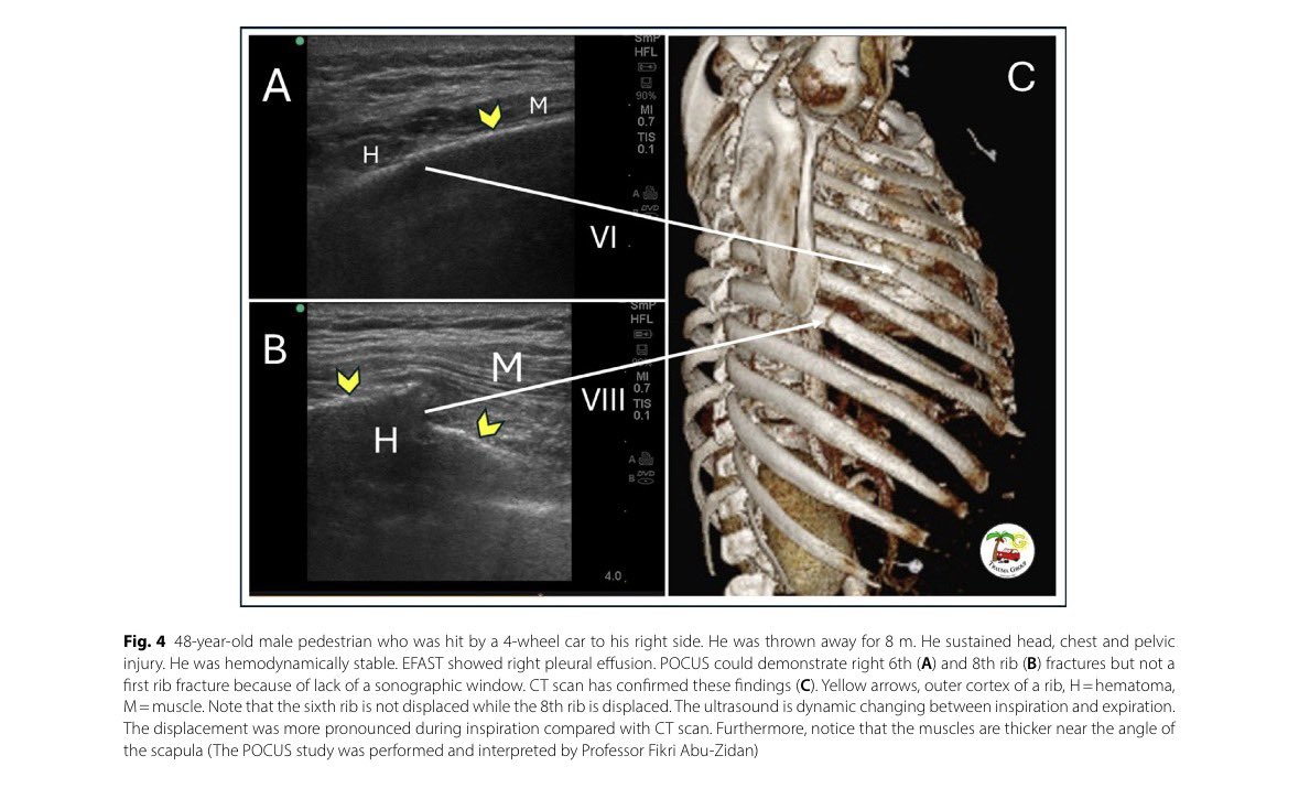 CardioMotorizado tweet media