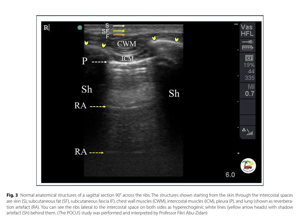 CardioMotorizado tweet media