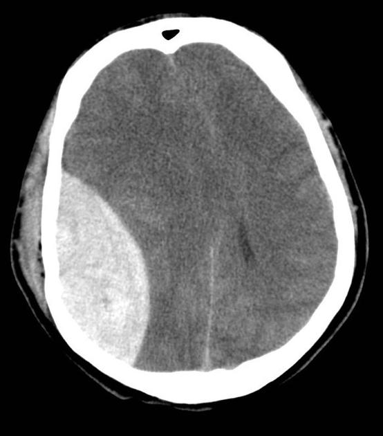CardiovascularCorner tweet media