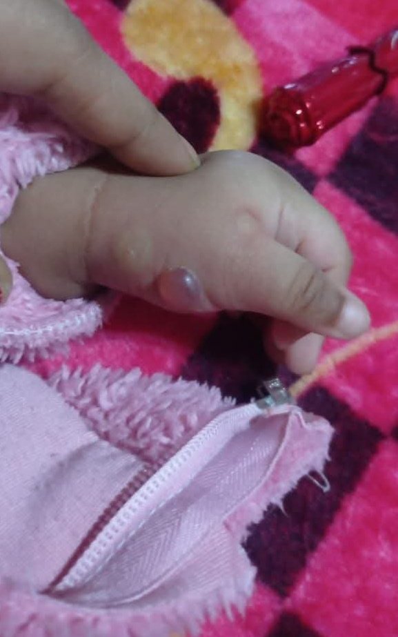 My sister's hand is inflamed and burned. Please pray for her speedy recovery. She's in a lot of pain and I can't do anything. 
🇵🇸
🇵🇸
🇵🇸
🇵🇸
🇵🇸
🇵🇸
🇵🇸
🇵🇸
🇵🇸
🇵🇸
🇵🇸
🇵🇸
🇵🇸
🇵🇸
🇵🇸
🇵🇸
🇵🇸
🇵🇸
🇵🇸
🇵🇸
🇵🇸
🇵🇸
🇵🇸
🇵🇸
🇵🇸
🇵🇸
🇵🇸
🇵🇸
🇵🇸
🇵🇸
🇵🇸

If you see this, leave even a dot 
gofund.me/c8ec2665e
