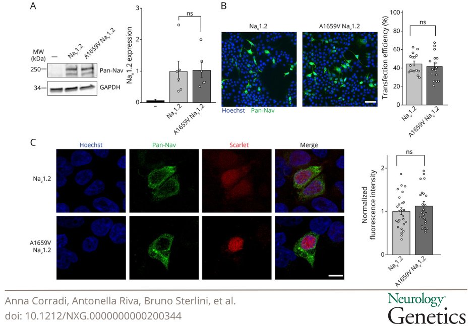 GreenJournal's tweet image. Functional Characterization of a De Novo SCN2A Mixed Variant Linked to Early Infantile Developmental and Epileptic Encephalopathy hubs.la/Q042M2YL0 

#NeuroTwitter #Epilepsy