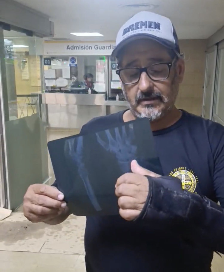 Este linyertario se hizo el pobrecito fingió que se había lastimado, pidió guita y se compró una moto. 
Si los boludos se exportaran seríamos Noruega.