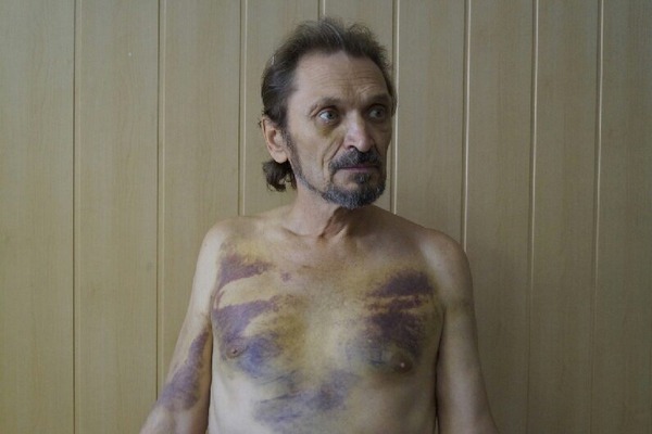 В цей день 2018 року від травм отриманих під час тортур росіянами помер Олександр Хомченко (1958—2018)— пастор протестантської церкви «Слово життя» (Донецьк). У 2014 організатор «молитовного Майдану». Рос.окупанти катували його на дибі. Нагороджений орд. «Народний Герой України».