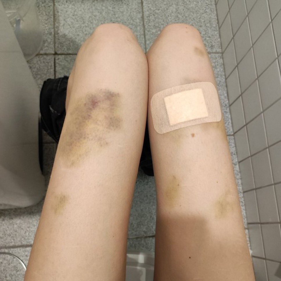 bonez 🦴 (@myspaceforevr) on Twitter photo 