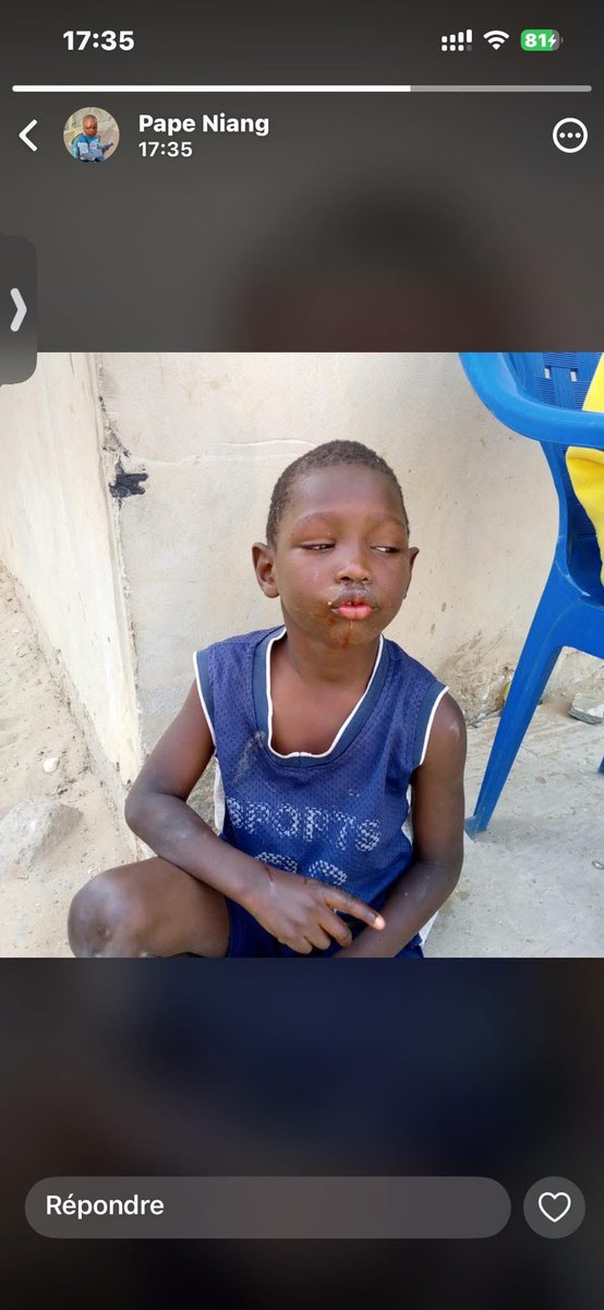 Bonjour 
Il s’appelle Gora dafa rér actuellement mogui Malika.

77 969 95 18