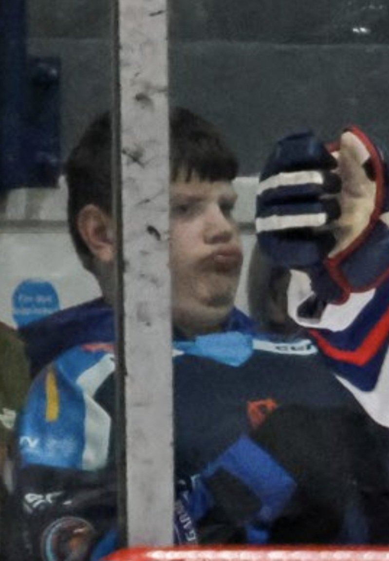 Face At The Plexi tweet media