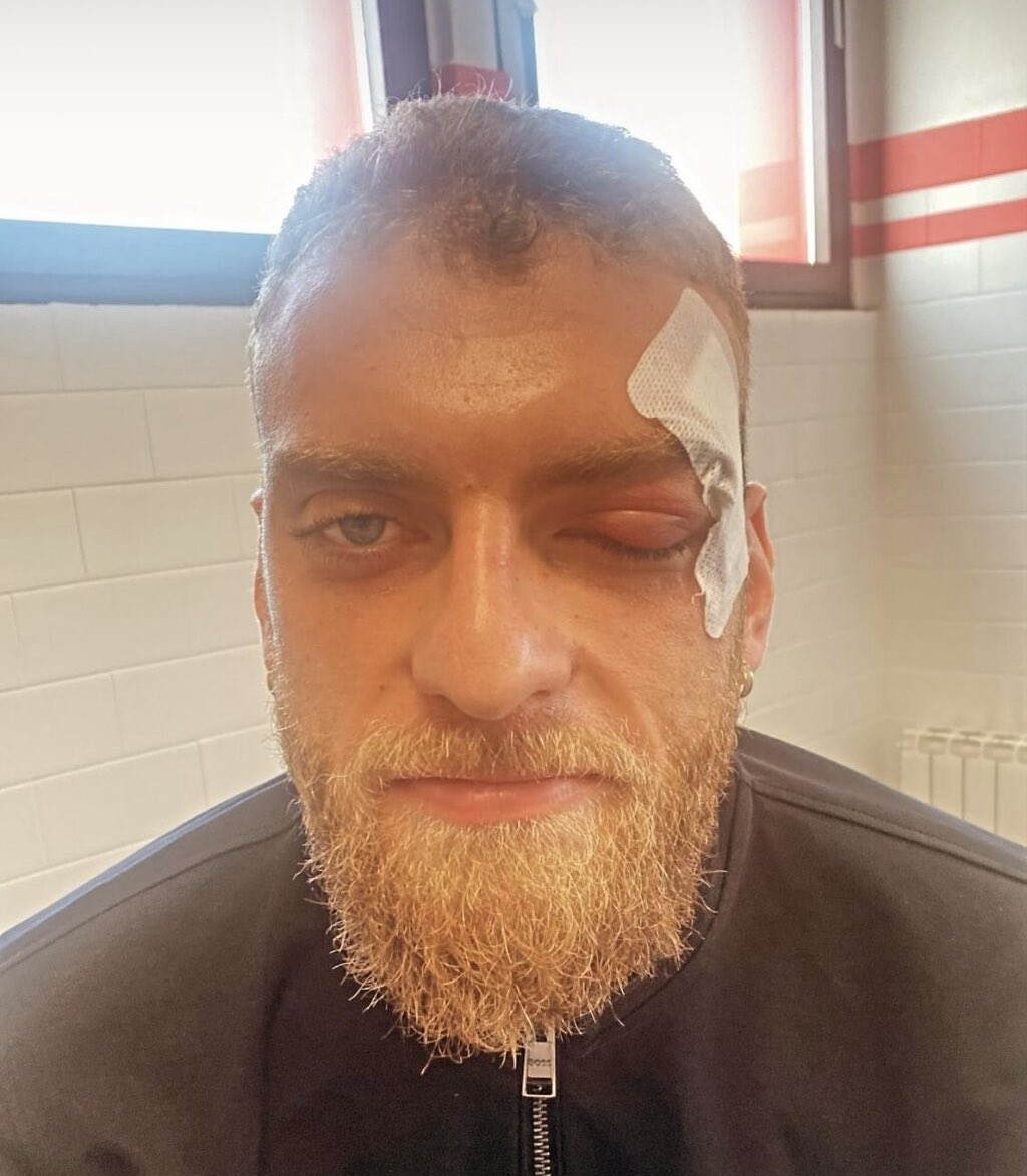 Lapo El(dio)kann tweet media