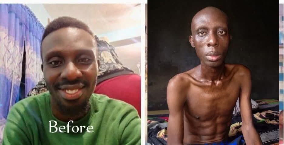 AkposMalafakumo's tweet image. MARK MARK JOHN
Once a fine vibrant young man robust with the fire to advance the society with his exceptional aspirations now back pedaled by the greaseless chains of Cancer.

He was diagnosed with OROPHARYNGEAL CANCER 2years ago, though hardly secured some sessions of