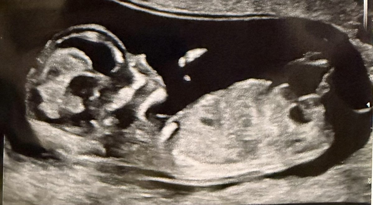 Paul Joseph Watson tweet media