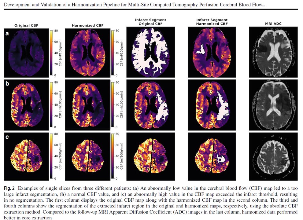Aravind Ganesh tweet media