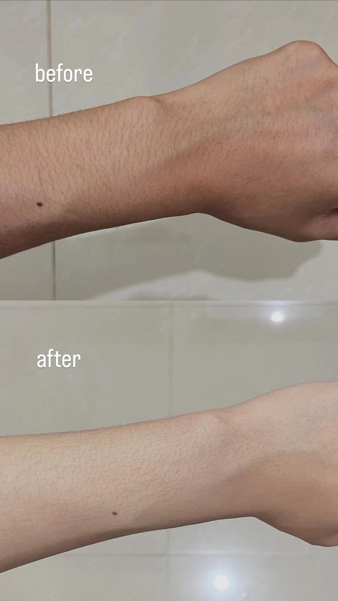 TOLONG BELI INI GUYS!!! 🍑

Awalnya cuma expect lembap doang, eh ternyata kulit jadi super halus &amp; smooth.

This produk                 before-after