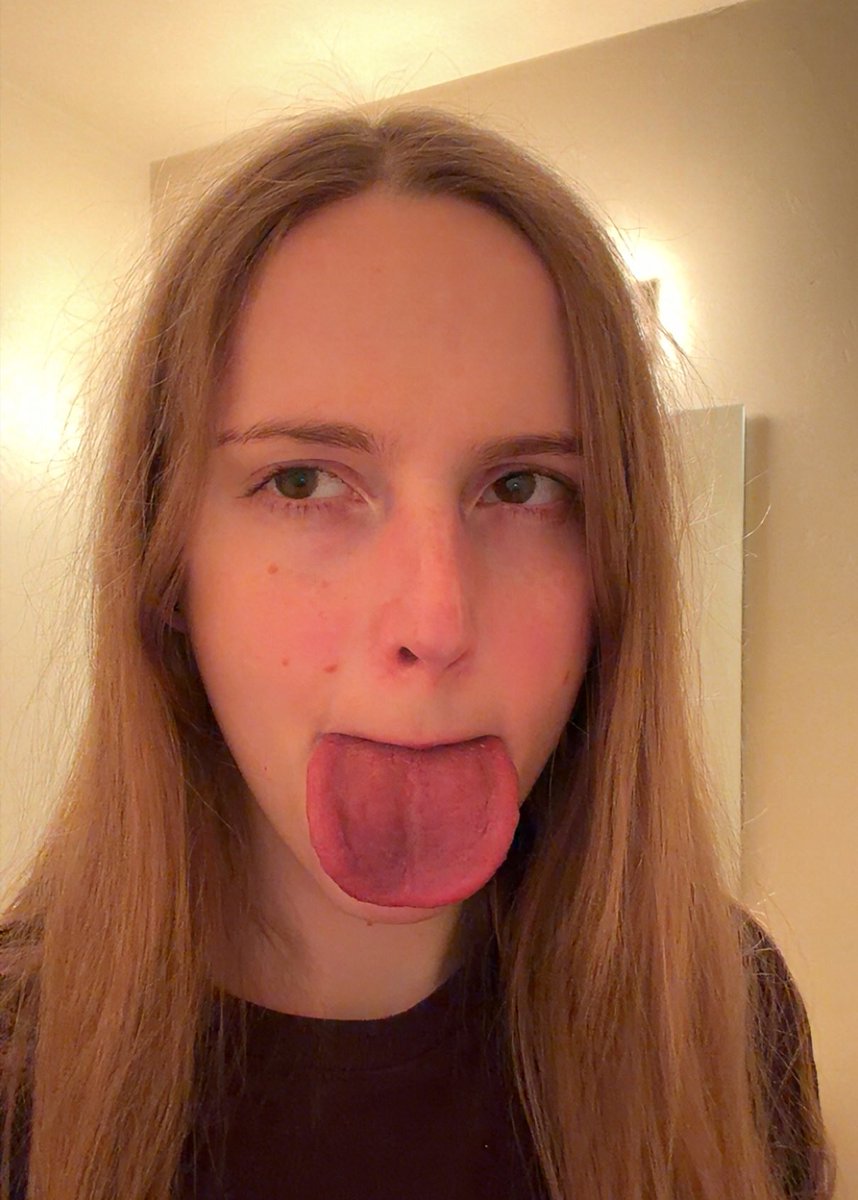 alex 🍓 tweet media