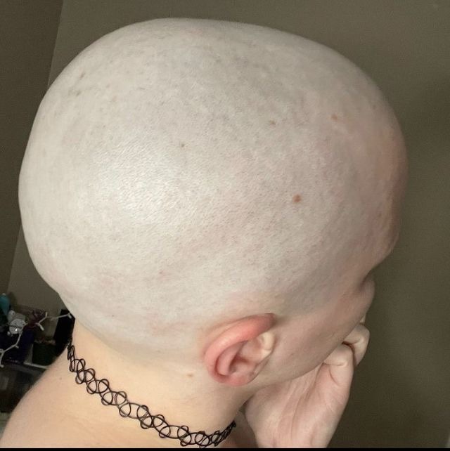 スキンバージン坊主☆ tweet media