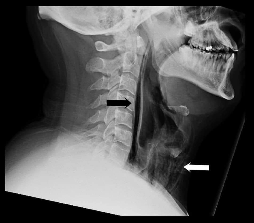 C.Alberto Ortega tweet media