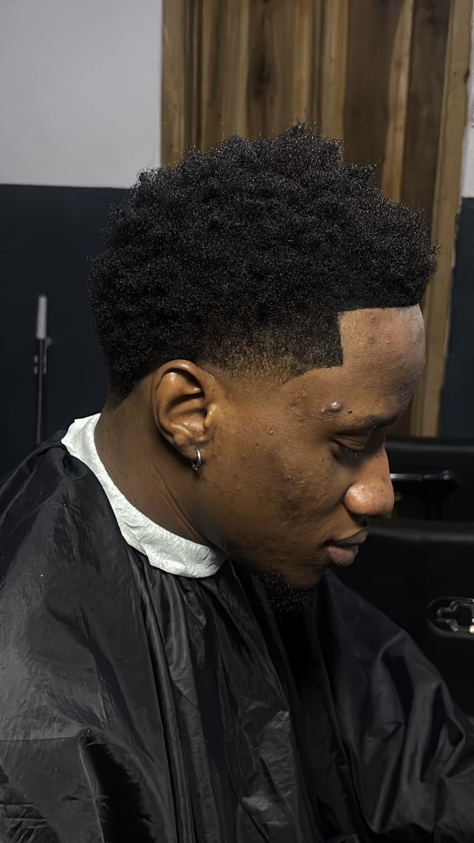 Acewrld247's tweet photo. Hair revival.💈 https://t.co/Hs7fGAoXm4
