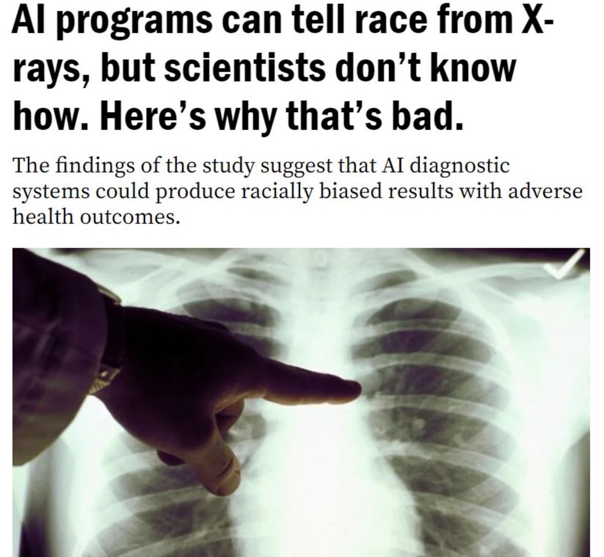 Oh you don't say. 😂

"There’s also the possibility that the results of the study show some innate difference between races."

boston.com/news/health/20…