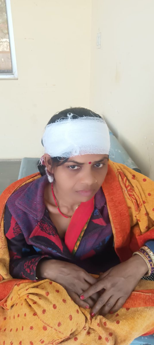 ShivaKumar61041's tweet photo. शिवराजपुर थाना क्षेत्र रौतापुर गांव के दबंगों ने महिला को जमकर लाठी डंडों से पीट दिया
सुबह 7 बजे से महिला थाने के बाहर बैठी रही पुलिस ने उसका मेडिकल नहीं करवाया
अब महिला सीएचसी पहुंची लेकिन वहां भी पुलिस मजरूमी चिट्ठी नहीं गई महिला की हालत गंभीर
@Uppolice
@kanpurnagarpol https://t.co/KBMLcG16nx