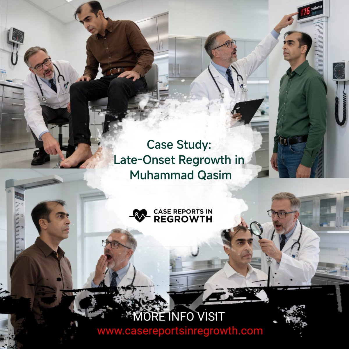 Muhammad Qasim experience his height increasing day by day