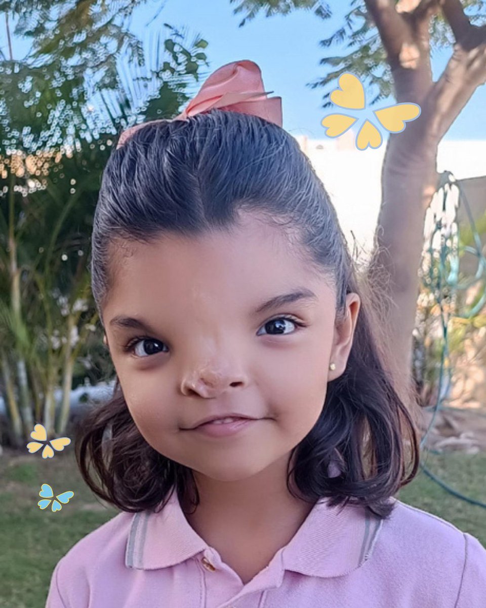 CCAKids - Children's Craniofacial Association tweet media