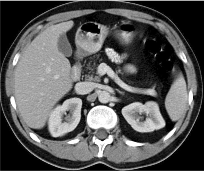 Giovanni Marchegiani tweet media