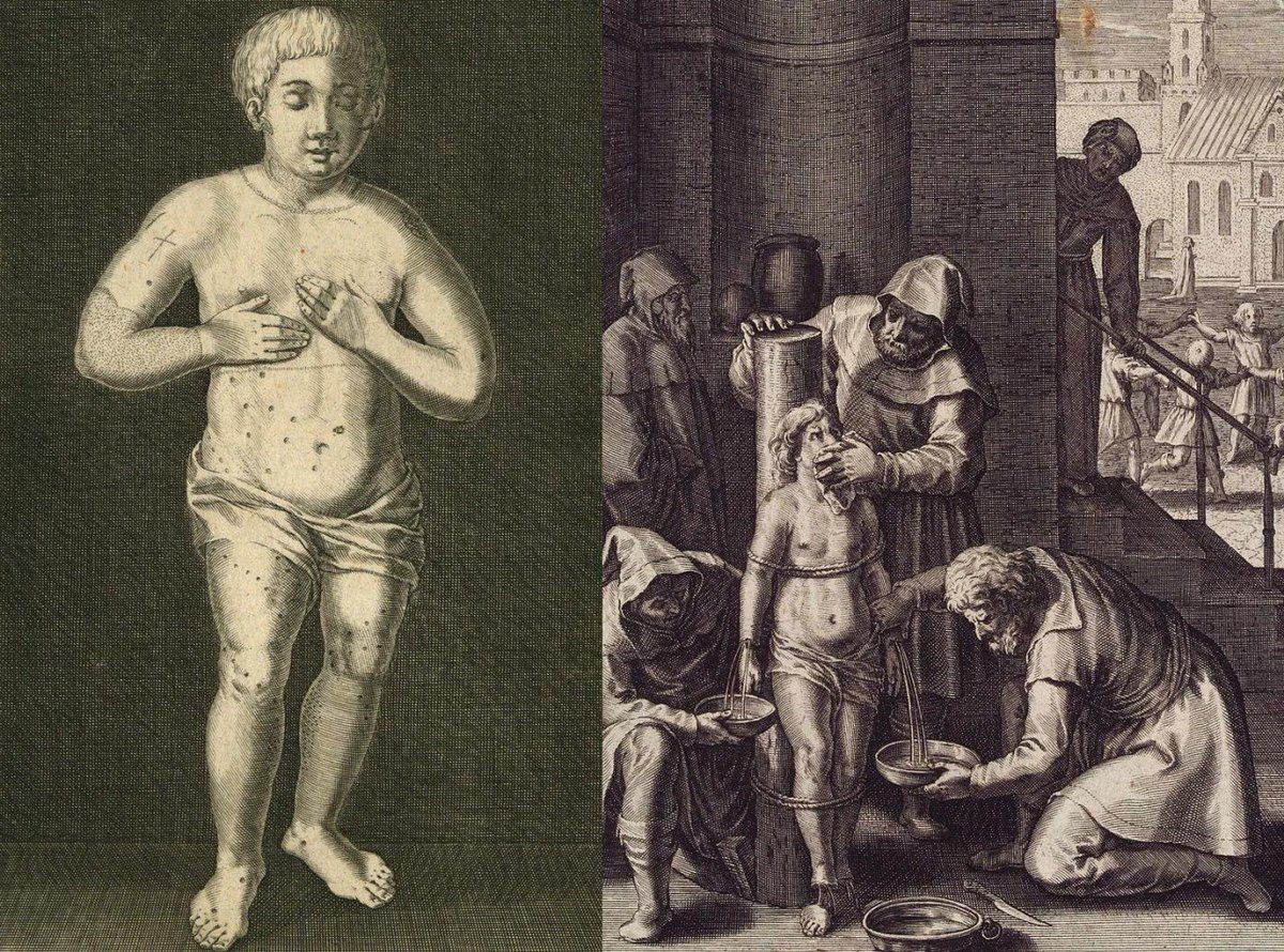 Przed Epsteinem: oszczerstwa krwi…czyli koszerne mordy rytualne wykorzystania krwi gojów do odprawiania rytuałów religijnych. (ciąg dalszy)
Część II
vtforeignpolicy.com/2026/02/censor…