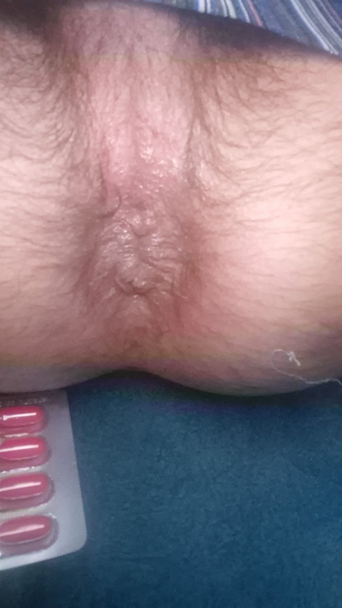 Pasapelo777's tweet photo. La candelaria ya 🛁🍑🍼 https://t.co/uIL7LMeDM8