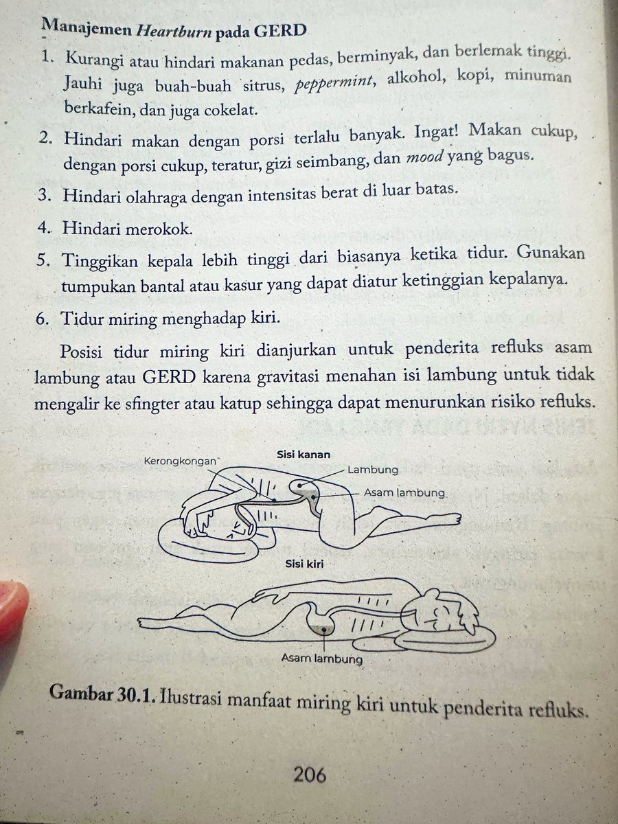 afrkml's tweet image. SEBELAS #TIPS puasa aman utk yg punya GERD:

1. Selalu sahur
2. Tidur miring kiri/istirahat ½ duduk
3. JANGAN tidur/rebahan setelah sahur &amp;amp; berbuka
4. Kenali trigger aslam-mu
5. Kurangi mam berlemak tinggi, coklat, pedas, buah sitrus, kopi
6. Stop rokok
6. Olahraga ringan–sedang,…