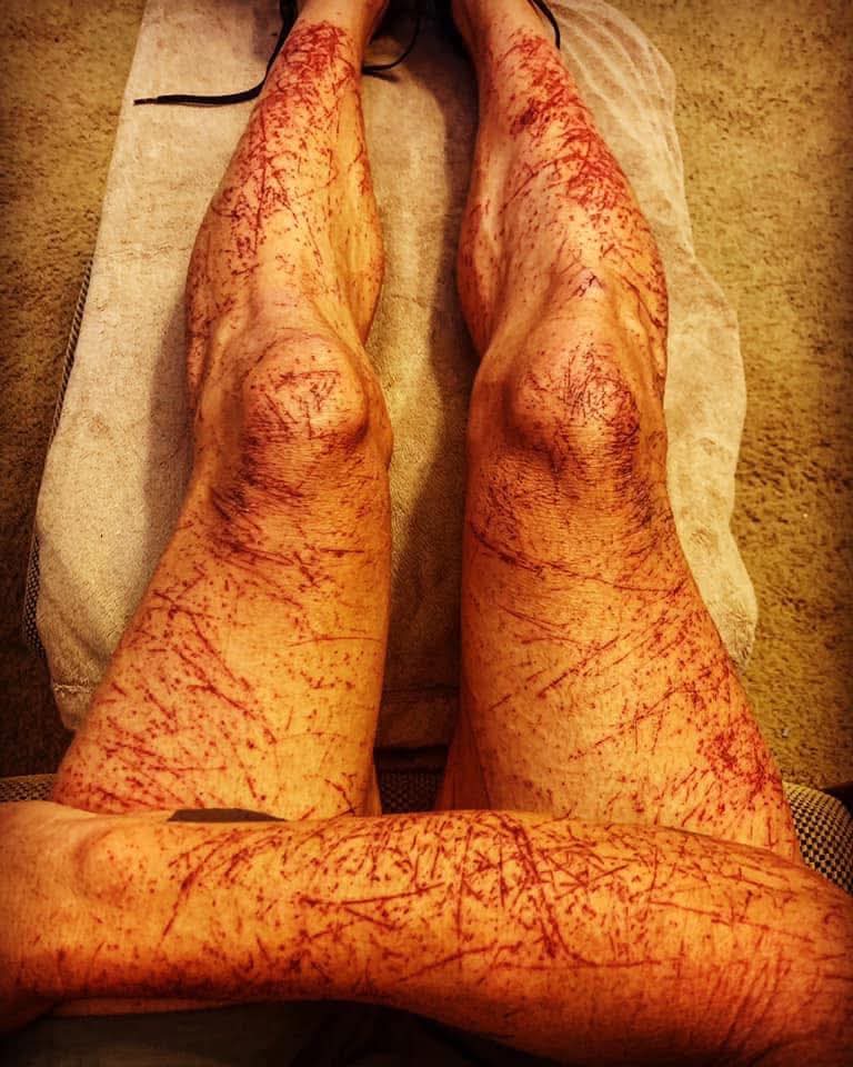 And all was nearly lost. Four runners on loop 3. Will Barkley win again? #BM100