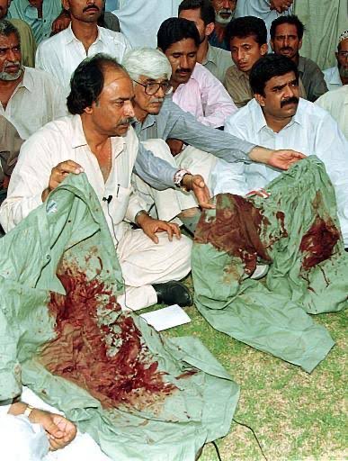 MASUD_MUFC's tweet photo. You should be glad Imran Khan has decent facilities. 4-star stay, choice of meals even a mini gym. If he was treated like Asif Ali Zardari  he won't last long. Zardari was so badly injured that even authorities claimed he self-harmed. https://t.co/XYHvy3l6Qu