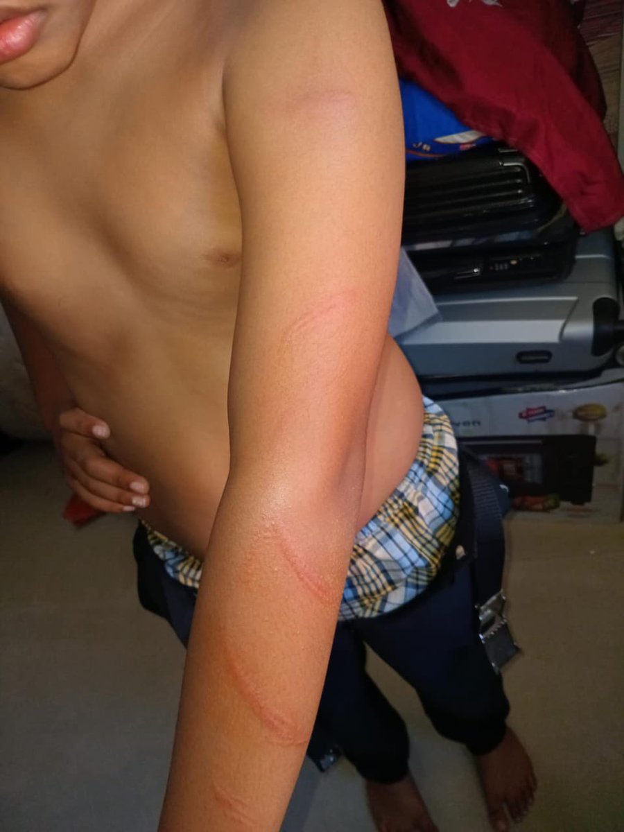 HKurusee's tweet photo. Confirmed.

Shanoof Ali (S. Hithadhoo) has attacked a 12 year old boy (his stepson) at his home.

The biological father is begging police and Gender Ministry to investigate the case. It’s been days and no action taken.

The child is living in fear, with this monster stepfather Shanoof.
