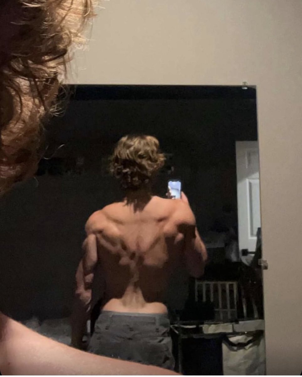 Benji's Braces 😈 tweet media