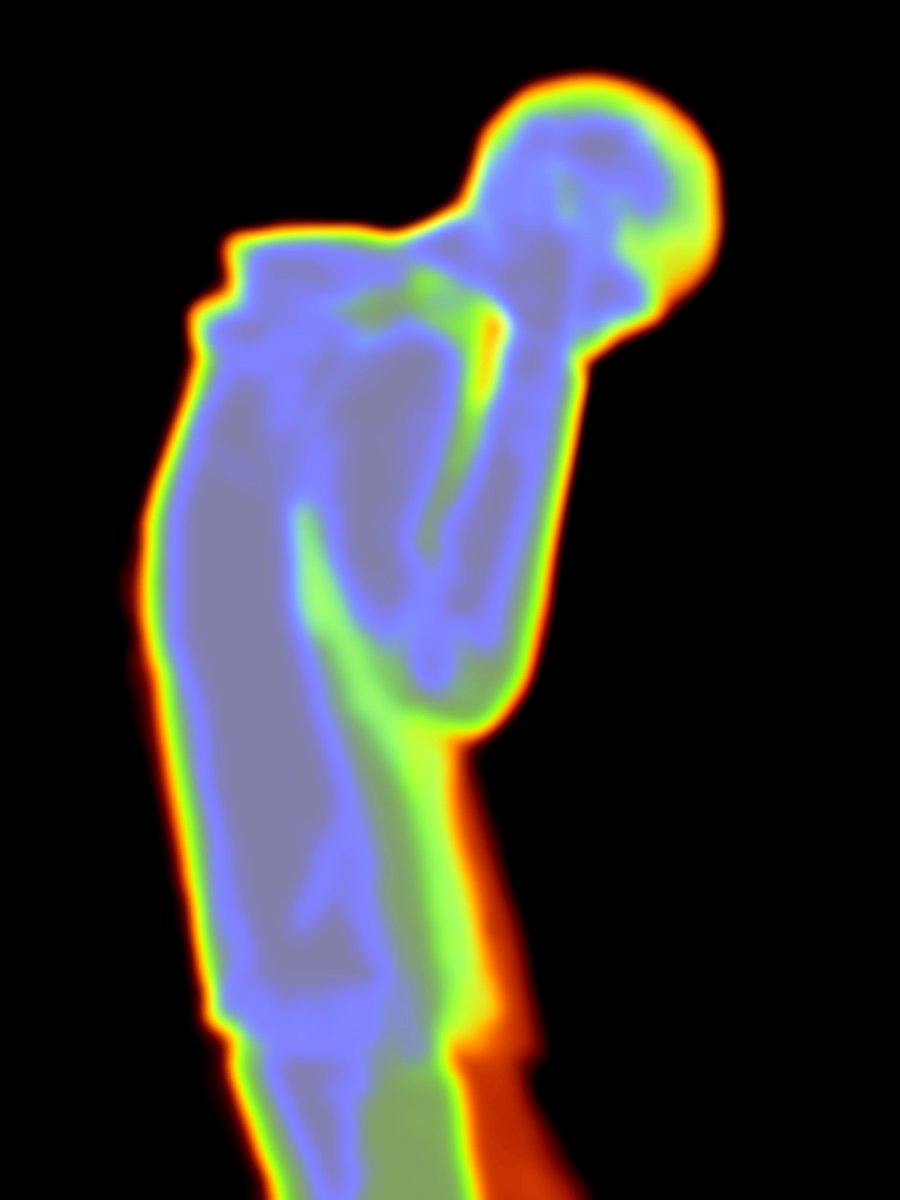 病人 (@sch1z0_dipshit) on Twitter photo 