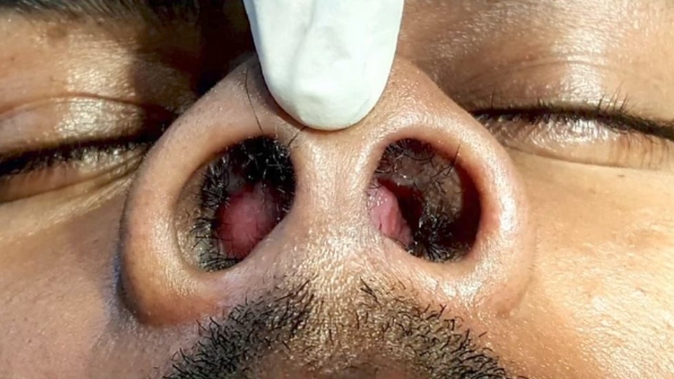 nervemed tweet media