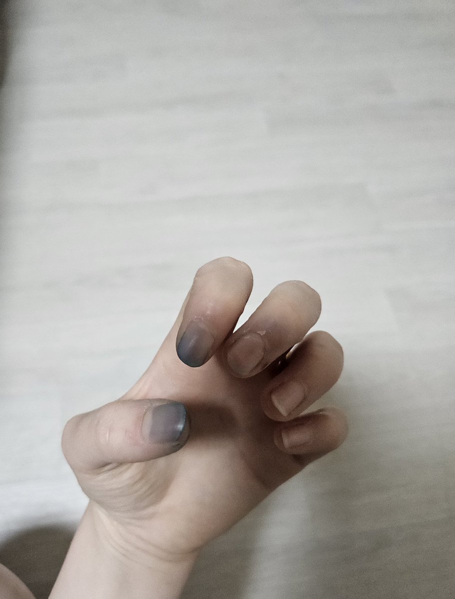 ㅋㅋㅋㅋㅋㅋ 까만손 하니까
생각난건데 혼자 염색하다 망했자나
목이랑 손 지우는데만 3일 걸렸짜나

안물 안궁이라고?
그냥 읽어줘 쓸거 없어서 쓰는거니까