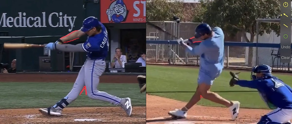 tommym8's tweet photo. Jac Caglionone had 1.025 OPS over 264 Milb at bats in 2025…

He had a .532 OPS in 210 MLB at bats in 2025….

He had a 1.419 OPS his junior year at Florida in 2024….

Jac uses the muscles of motor tract 2 on his right side when he’s at his best…..

He uses the muscles of motor tract 5 on his right side when he’s at his worst….

He’s using motor tract 5 so far this spring….

Watch his right wrist as it “turns over” through the baseball and you can see why motor tract 5 produces such awful results.

There is no reason that Jac should ever use motor tract 5 to swing a bat but since nobody in the Royals org knows what causes it to happen they haven’t been able to help him be at his best.