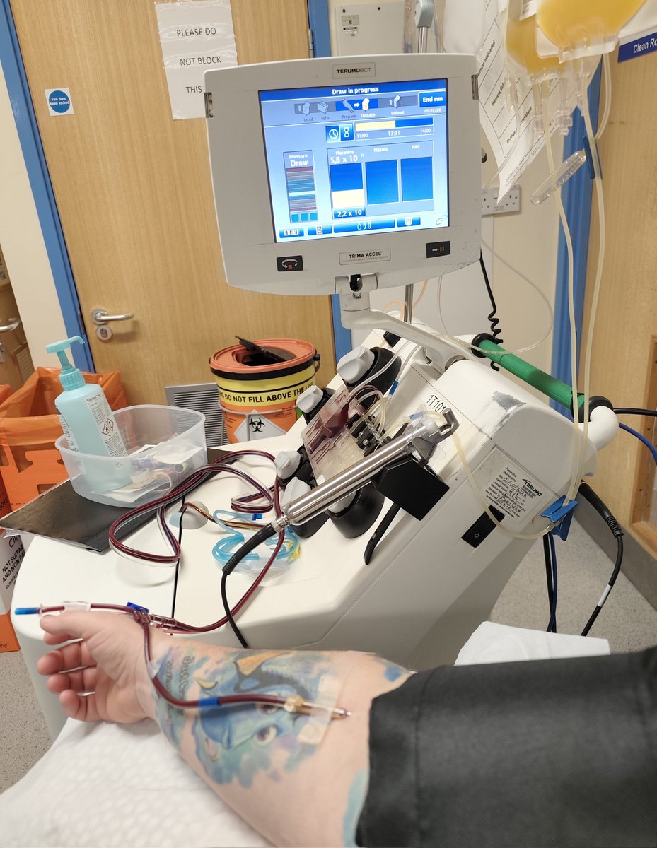 UFCSpecialHead's tweet photo. Platelet donations 95+96. Just a double today as my platelet count is a bit lower than usual - they didn't want to completely drain me 😄 
Hope you all find some good in today 🙏🫶 
#GiveBlood 🩸
#GivePlatelets 💛 https://t.co/BLCCxdogyF
