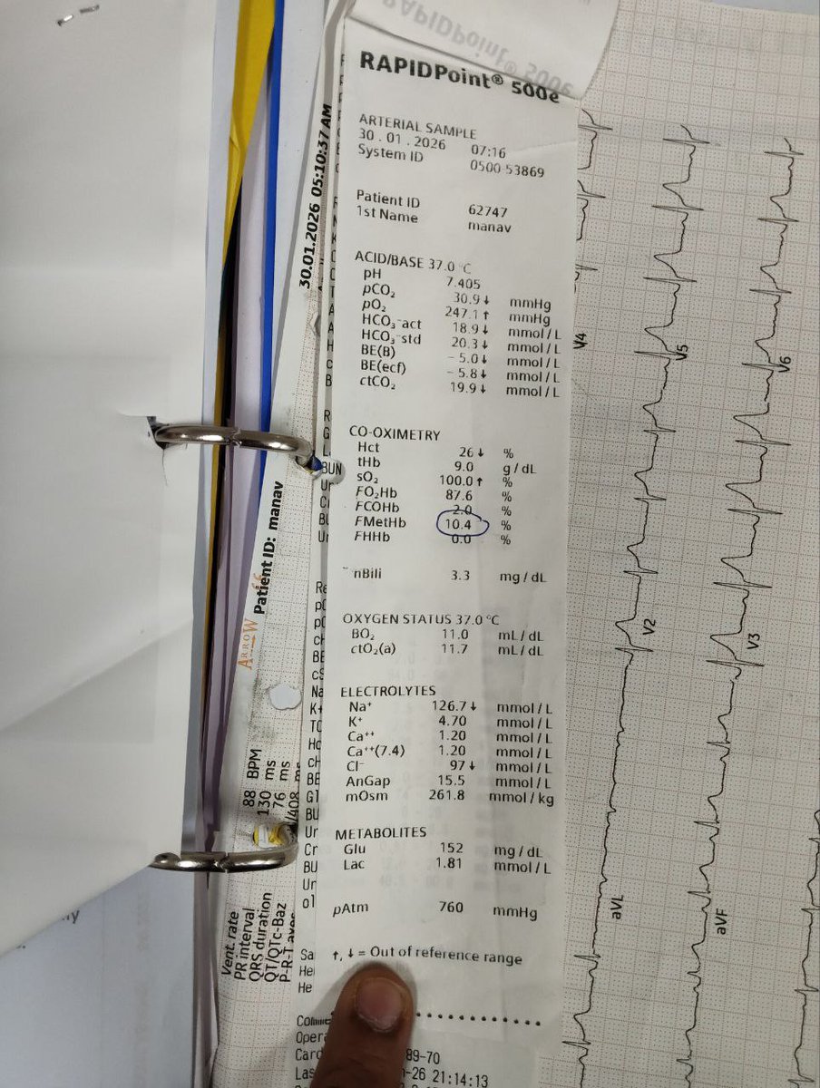 vinaykumarav's tweet photo. 1/6 Midnight Emergency Case 🩺🌙

1/ A 21-year-old male presented at midnight with:
🤕 5 days abdominal pain
🩸 Hematuria
😣 Uneasiness
Vitals:
BP 120/80
Pulse 100
RR 30/min
SpO₂ 68% (↑ to 73% on 6L O₂)
👀 Icterus
🫁 Chest X-ray: Clear https://t.co/E2WYTZjaSf